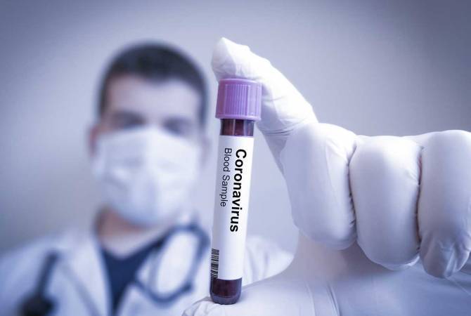 COVID-19: Armenia reports 515 new cases, 12 deaths in one day