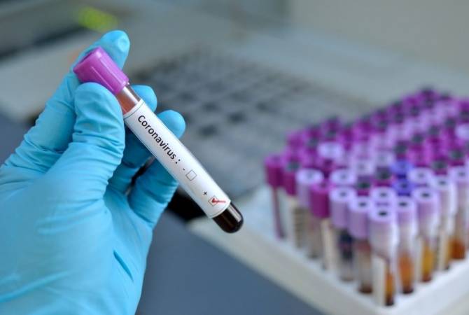 Artsakh confirms 7 new cases of coronavirus 