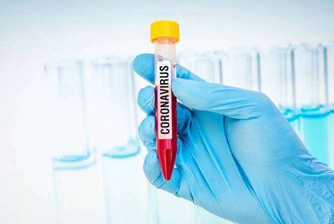 More than 47000 coronavirus test kits produced and supplied by Armenian scientists so far