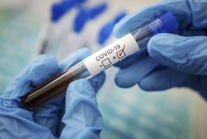 В Швейцарии зафиксировали резкий рост числа заражений коронавирусом