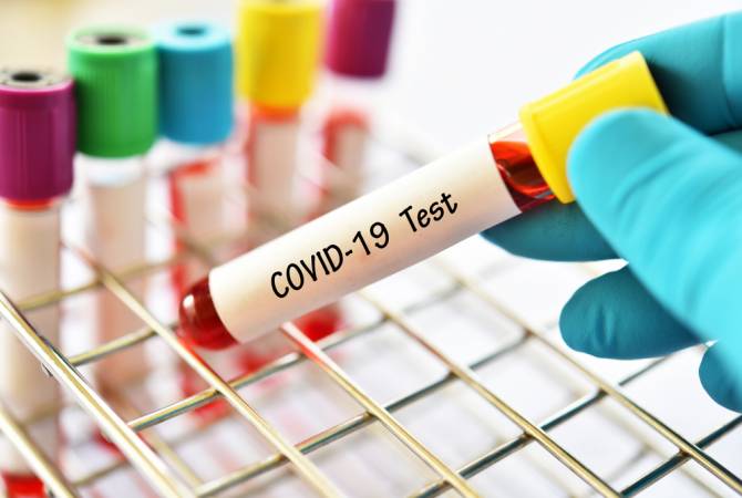 Armenian CDC reports 229 new cases of COVID-19