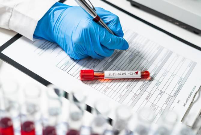 Не исключается взаимное признание тестов на коронавирус в рамках ЕАЭС: проектируется 
приложение 