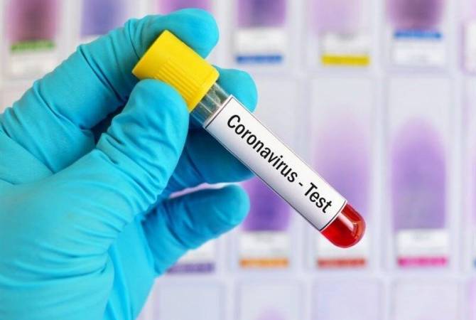 COVID-19: Armenian CDC reports 239 new cases 