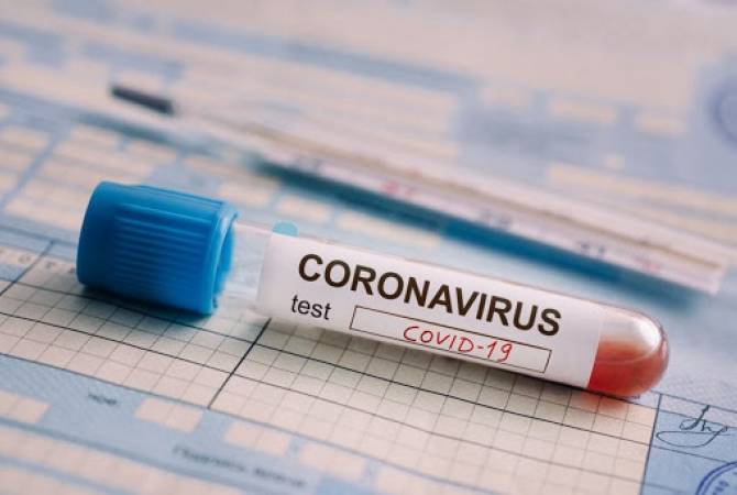 Armenia sees highest number of daily coronavirus cases since outbreak began 