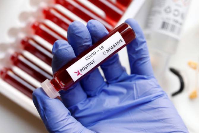 Russia conducts over 126 mln coronavirus tests