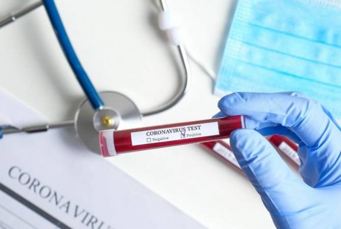 В Арцахе подтверждено 13 новых случаев коронавируса