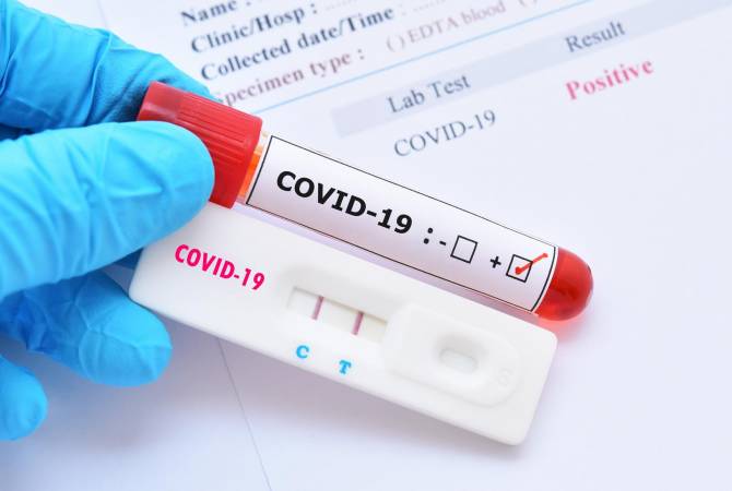 В Арцахе подтверждено два новых случая COVID-19

