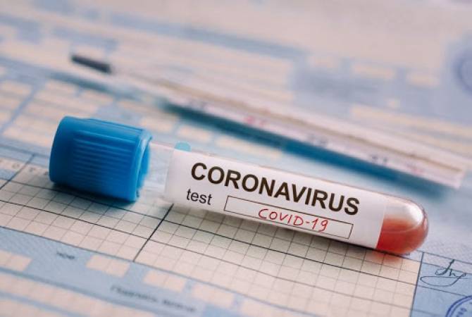 COVID-19 : 250 nouveaux cas confirmés en Arménie, 162 guérisons

