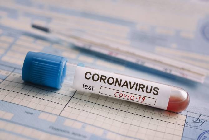 Կորոնավիրուսային հիվանդության չորս նոր դեպքեր Արցախում 