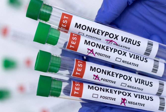 The WHO will hold a consultation to assess the risk of monkeypox virus