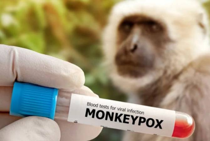  Первый случай смерти от оспы обезьян в США зарегистрирован в Лос-Анджелесе
 